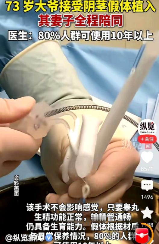 73 岁男子为比自己小 30 多岁的妻子改善夫妻生活，主动接受阴茎假体植入手术，
