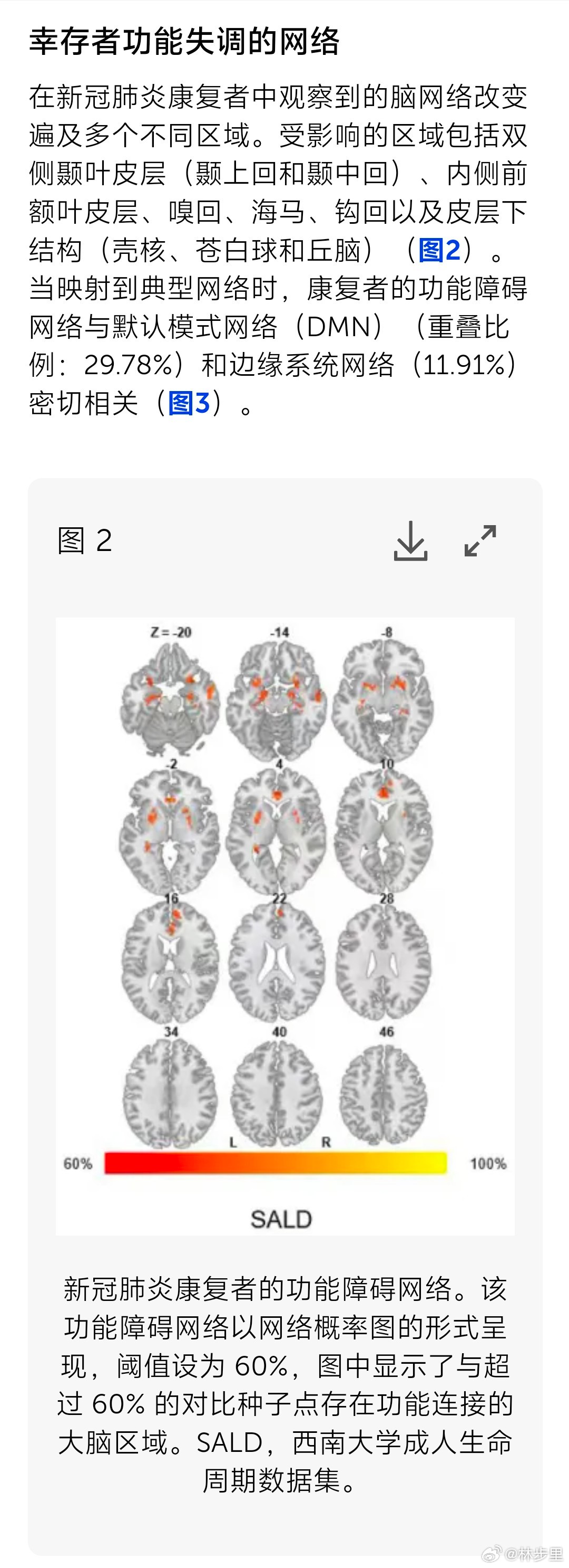 新冠伤大脑的脑网络定位。国内一项研究发现，新冠损伤的大脑网络，主要涉及默认模式系