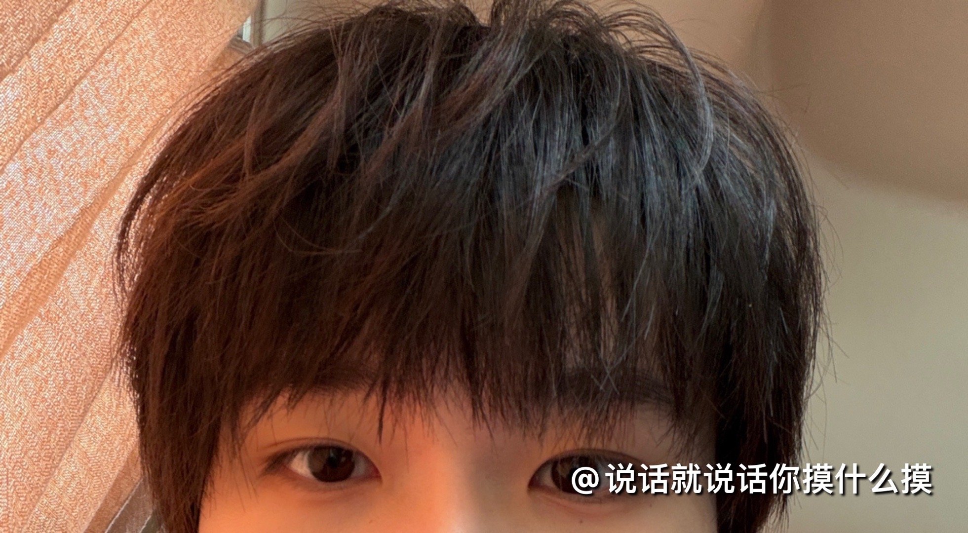 疑似不满瓜皮头 