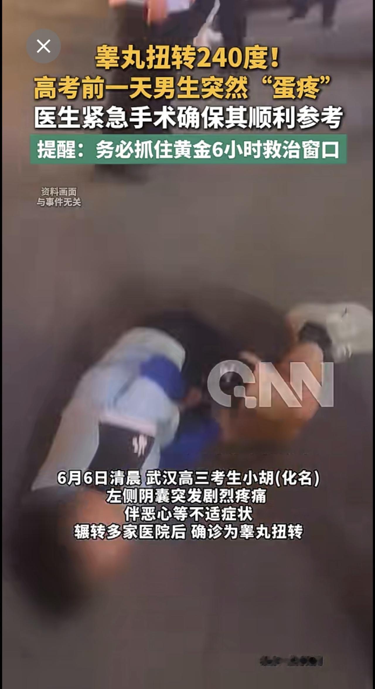 睾丸扭转240度！
高考前一天男生突然“蛋疼”
医生紧急手术确保其顺利参考 
提