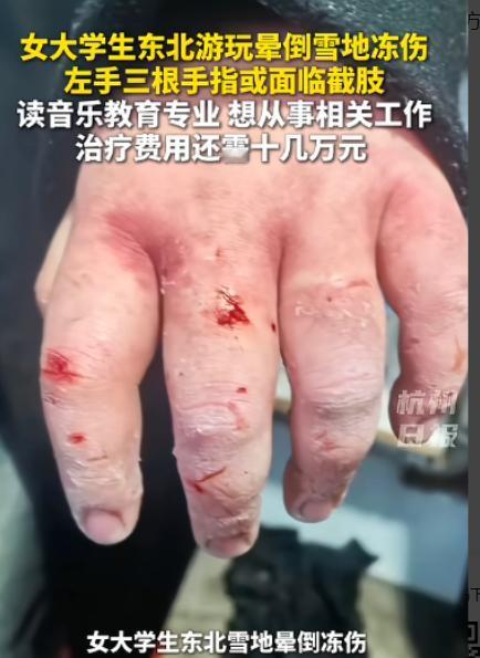 “悲剧还是发生了！”1月27日，黑龙江，一外地女生来旅游时，不慎意外摔倒，弄丢了