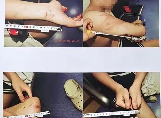 运城王某家长真让人看不懂

明明孩子把发小摔成轻伤二级

还找社会青年冒充警察二