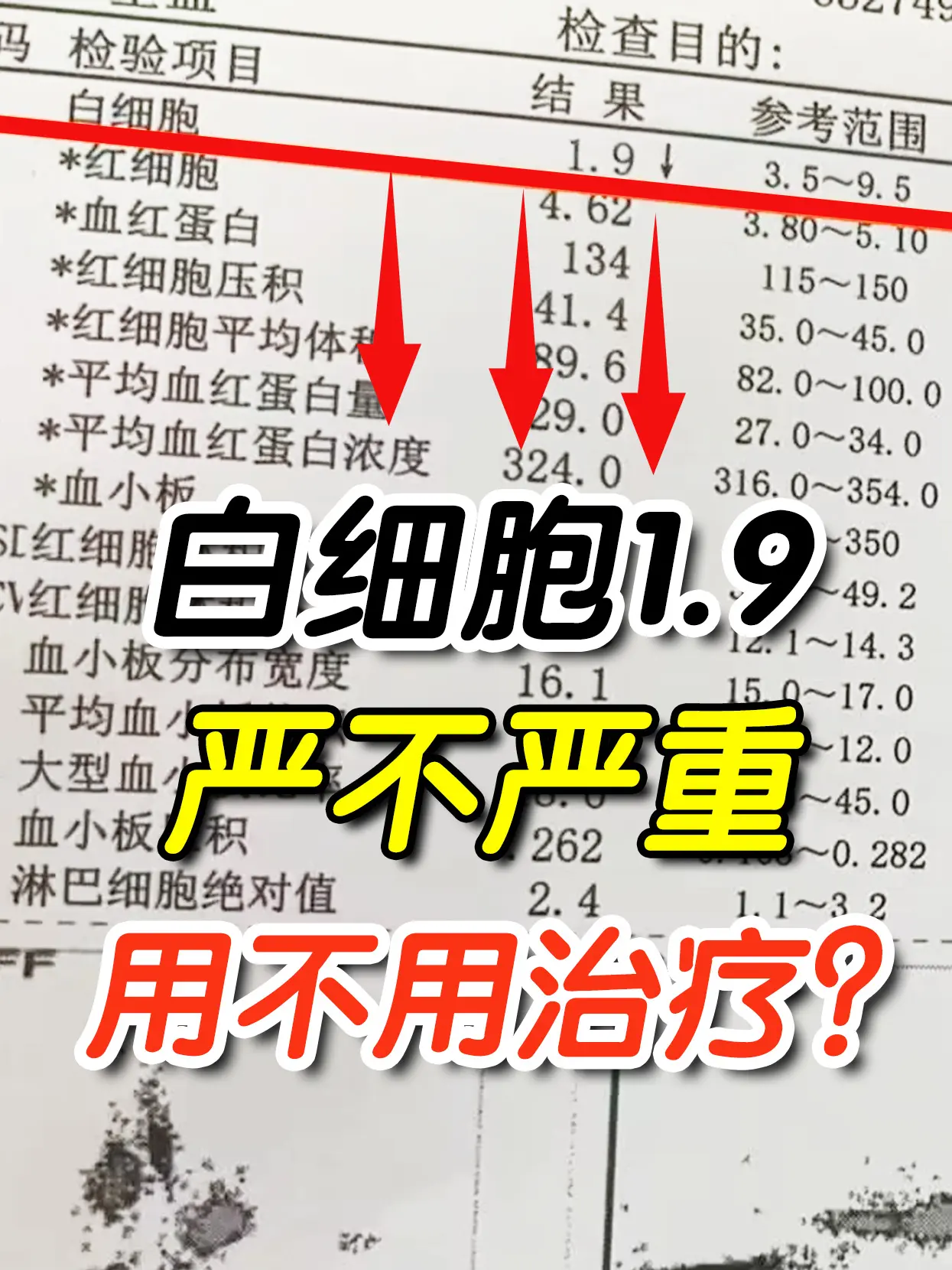 今天有个门诊的患者问我，他白细胞1.9！用不用进行治疗？首先我们说白细...