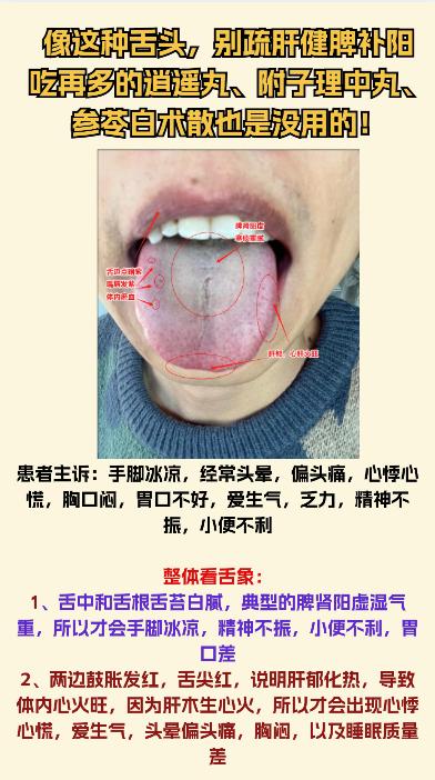 今日舌象分析