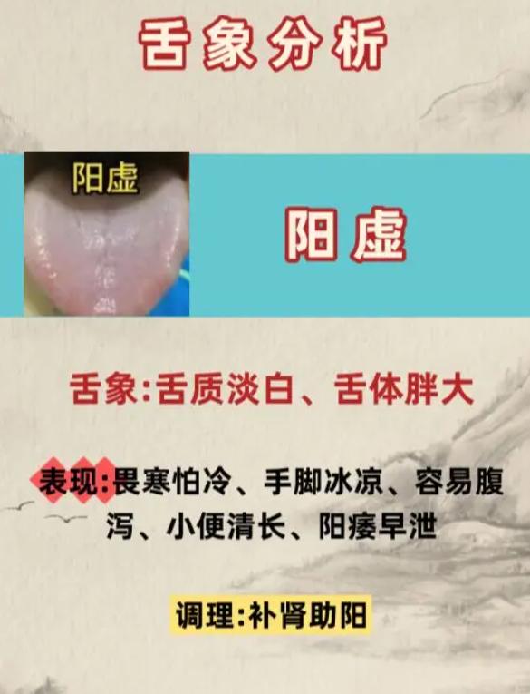 身体虚在哪？看舌头就知道，3 种虚证一眼分清