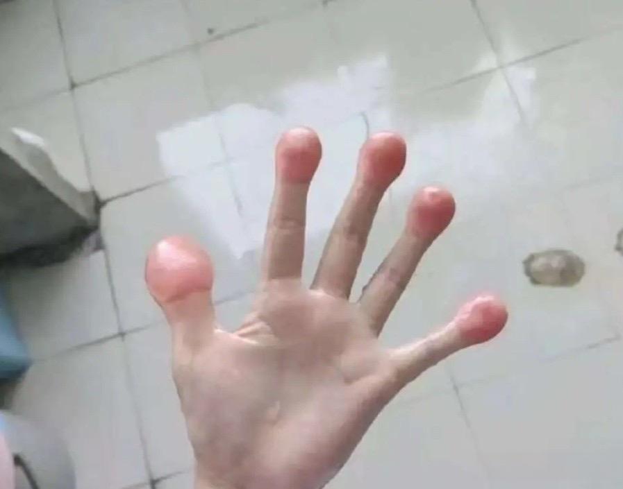 这手夹的吓人不