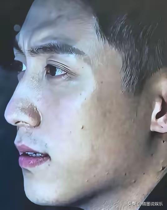 当去掉明星们的美颜滤镜，
他们的皮肤状态可能还不如普通人，
黄景瑜满脸痦子黑痣，