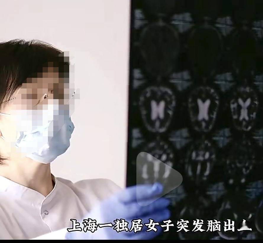 上海一独居女子突发脑出血陷入昏迷，却没有直系亲属签字，导致手术无法进行。好在这女