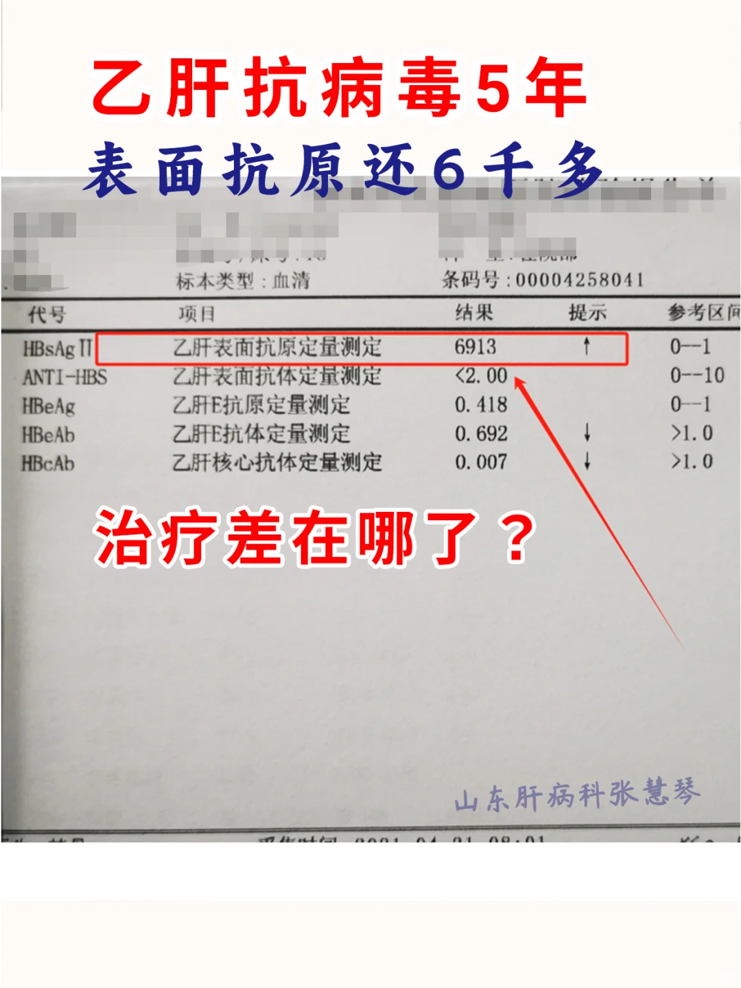 不懂就问！乙肝抗病毒5年，表面抗原还6千多