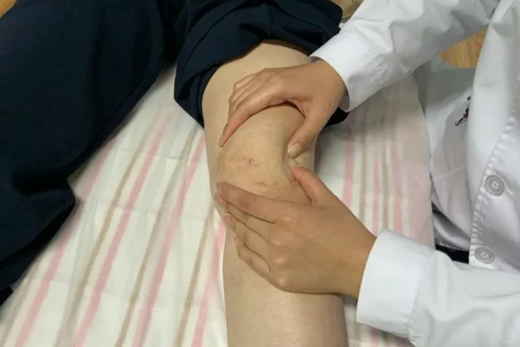 髌骨手术四十天恢复图