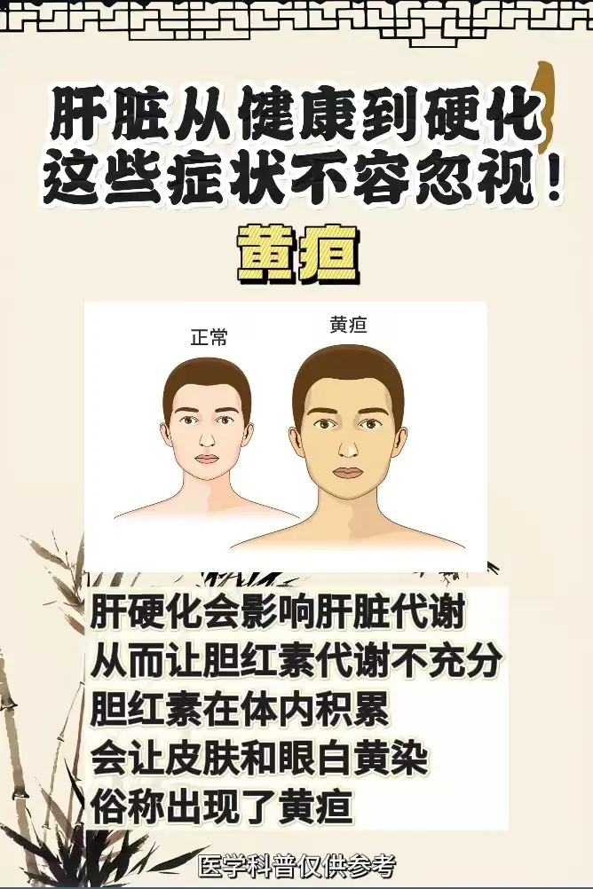 肝脏从健康到硬化，出现这些症状不容忽视！。