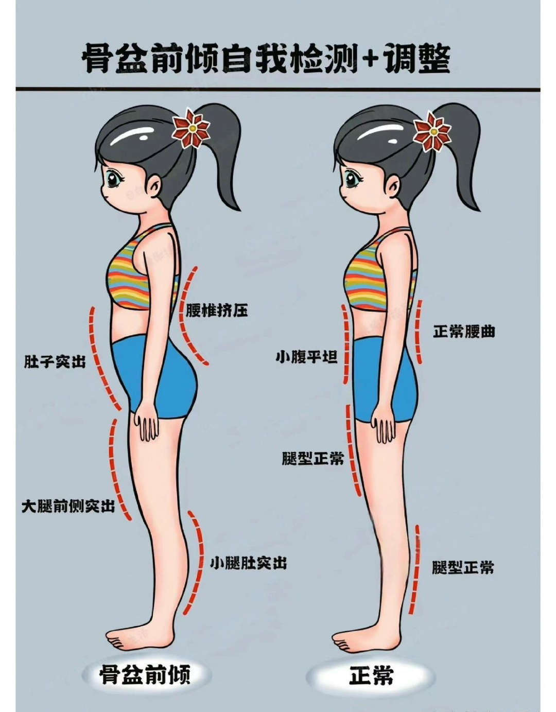 #有一种小肚子叫骨盆前倾# 骨盆前倾自我检测＋4个改善动作骨盆前倾：腰椎挤压，肚