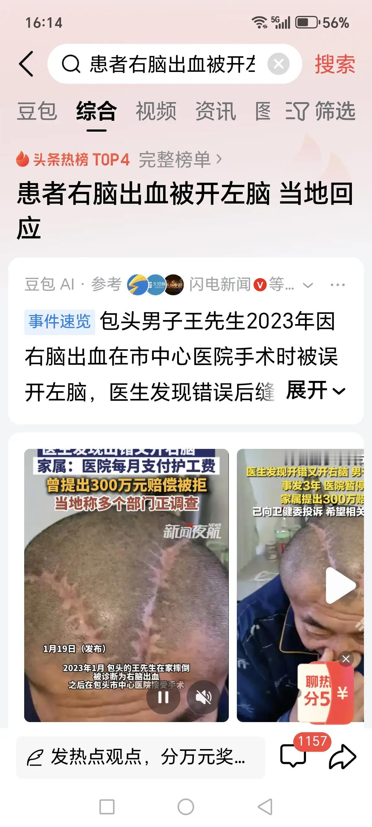 这个医生好恐怖，拿着人头当西瓜[震惊]

包头的王先生2023年1月，在家不小心