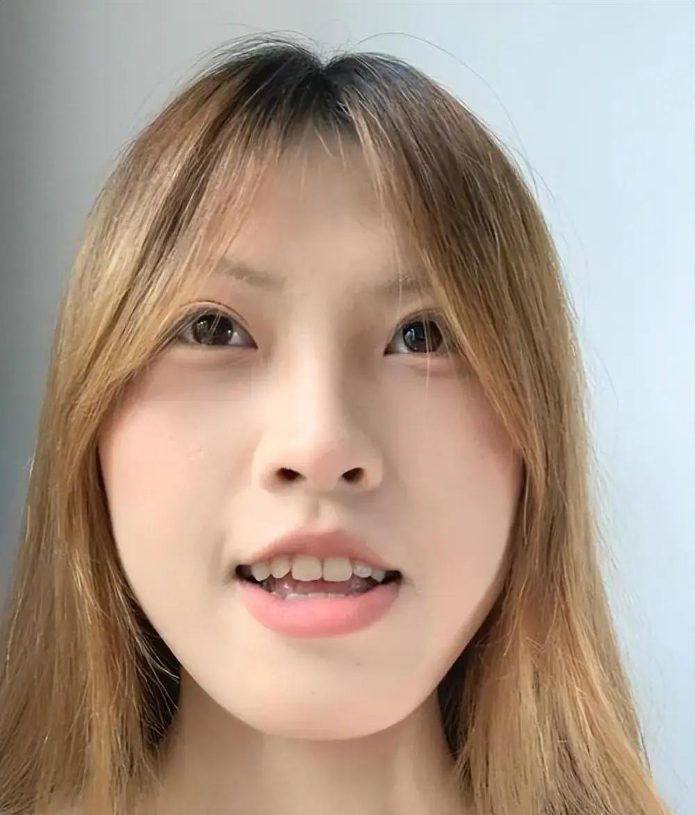 突然舌头打结，说话含糊不清？这竟是脑梗悄然逼近的致命信号，许多人却当成小毛病忽略