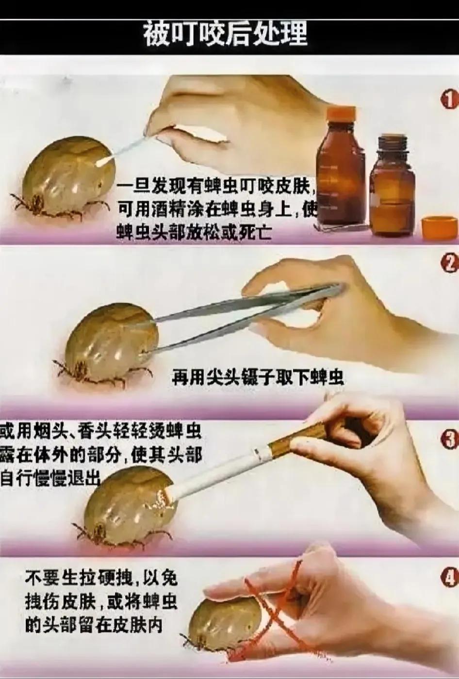 真没想到每年都有很多人因为蜱虫叮咬去世，这么个小虫子威力居然这么大，记得小时候家
