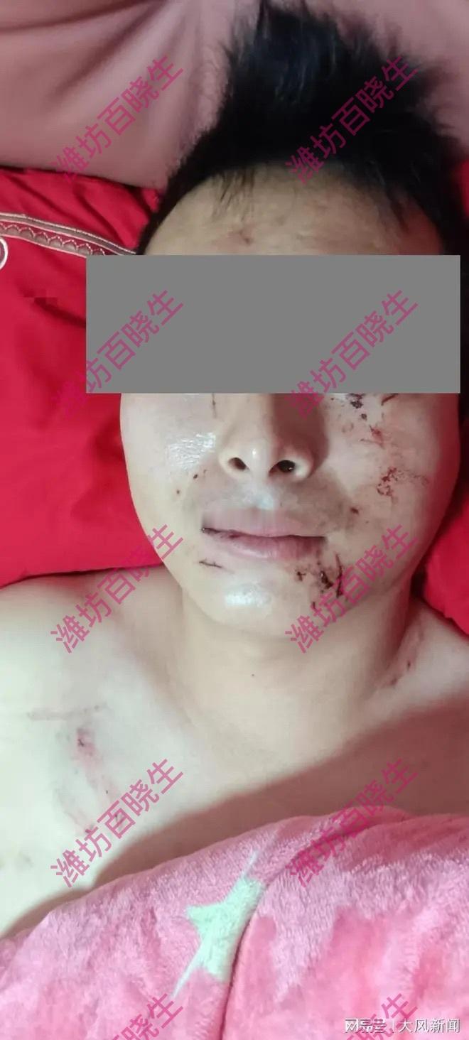 同城热点创作计划 这个案件确实引发了不少讨论。从法律角度来看，法院驳回起诉可能是