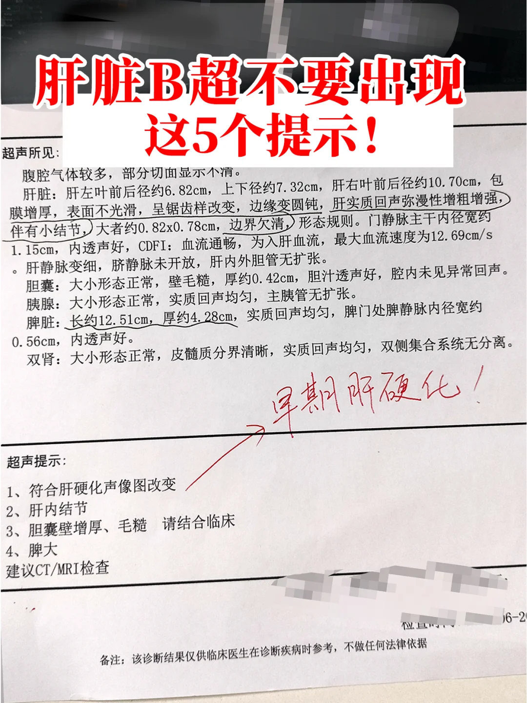 肝脏彩超没有这5个提示，说明病情还算稳定