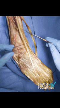 脚趾 从解剖看康复——你知道你的脚趾是如何勾起来的吗？连接大脚趾的肌肉称为𧿹长