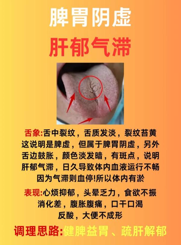 中医舌诊：三种常见证型，教你辨证调理