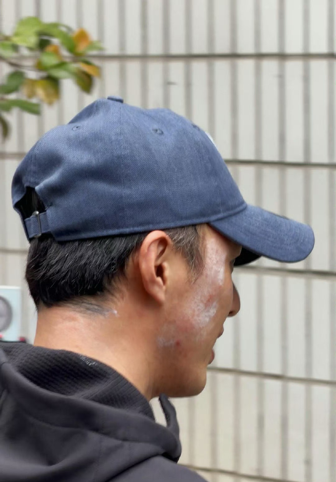 叶祖新的脸怎么了刷到叶祖新粉丝发的出妆图，叶祖新脸上涂满了白色药膏，还以为是怎么