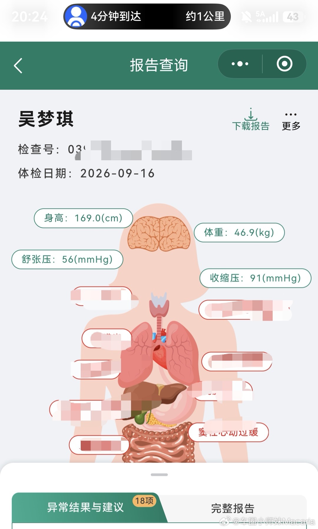 我的老天爷，我这体检报告是真的不敢往后翻[笑cry][笑cry]你们看自己的体检
