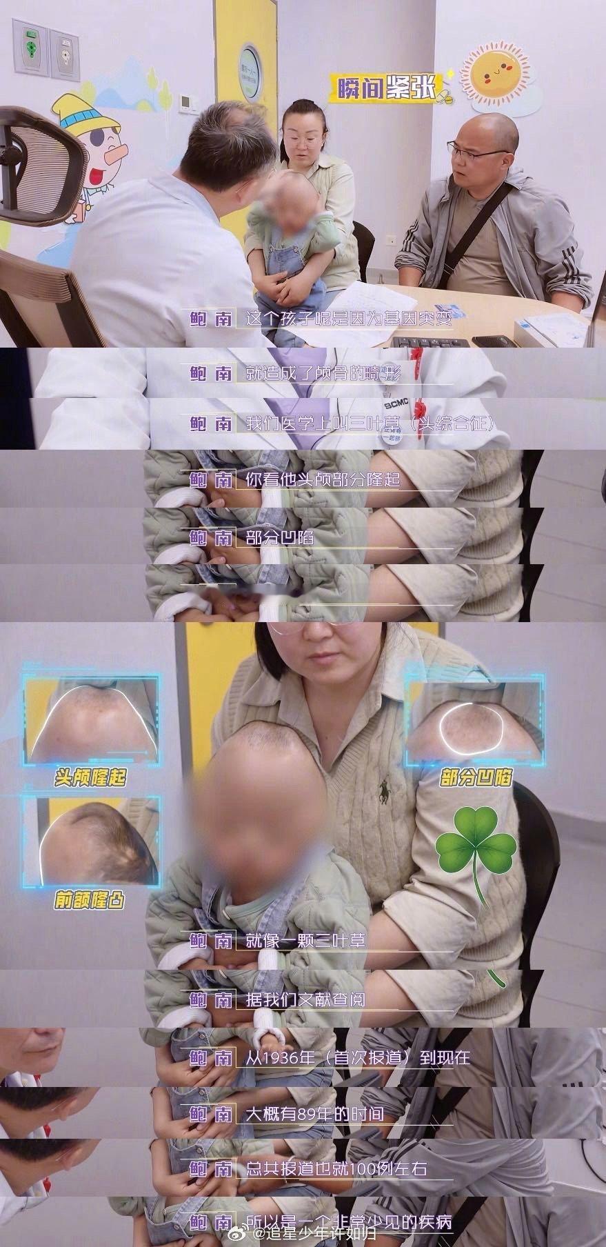 现代医学重塑2岁男孩头骨 《闪闪的儿科医生》这段看得人既揪心又震撼！2岁男孩的三