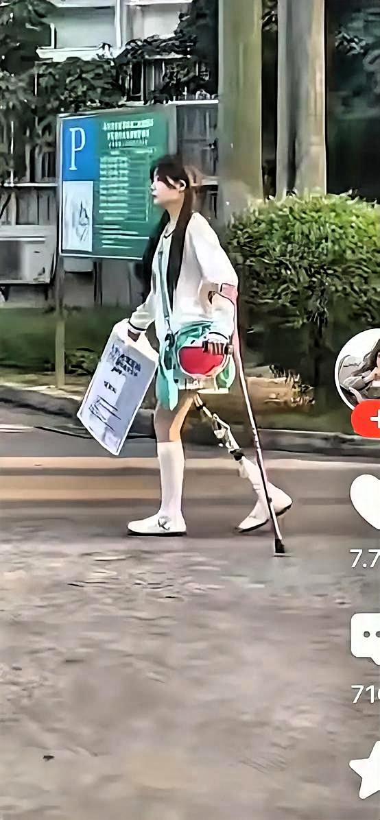 刷到这个女孩的瞬间，我真的被狠狠戳中了。命运对她如此刻薄，她却活成了最耀眼的模样