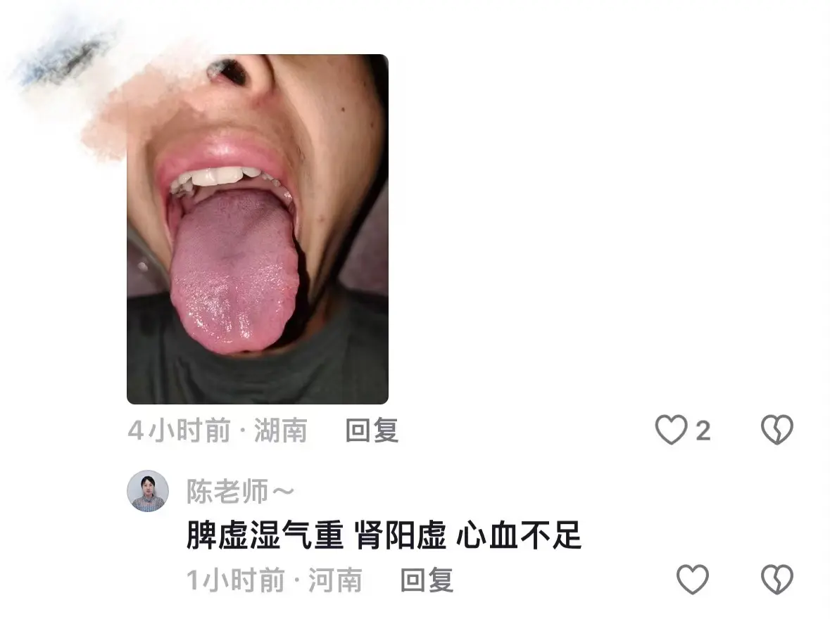 一定不辜负大家的信任，继续清晰准确辨证舌苔！ 1.脾虚湿气重，心火旺...