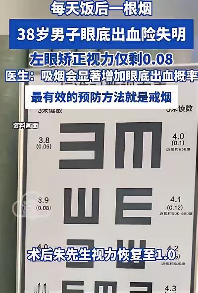悲剧还是发生了！饭后一支烟，武汉男子左眼险些彻底失明
 
4月29日，湖北武汉一