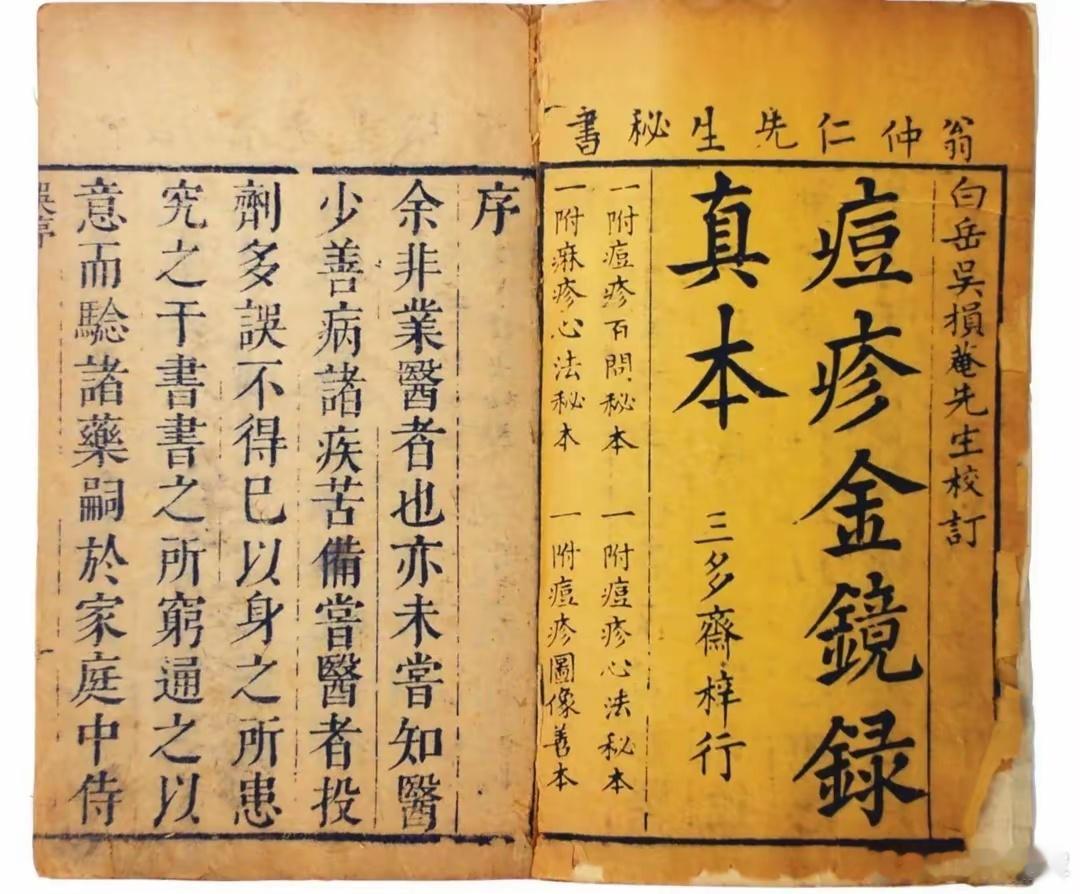 四磨汤：让胃肠不再 “添堵” 的古代良方胃肠不通，百病易生，这在医学领域是常识。
