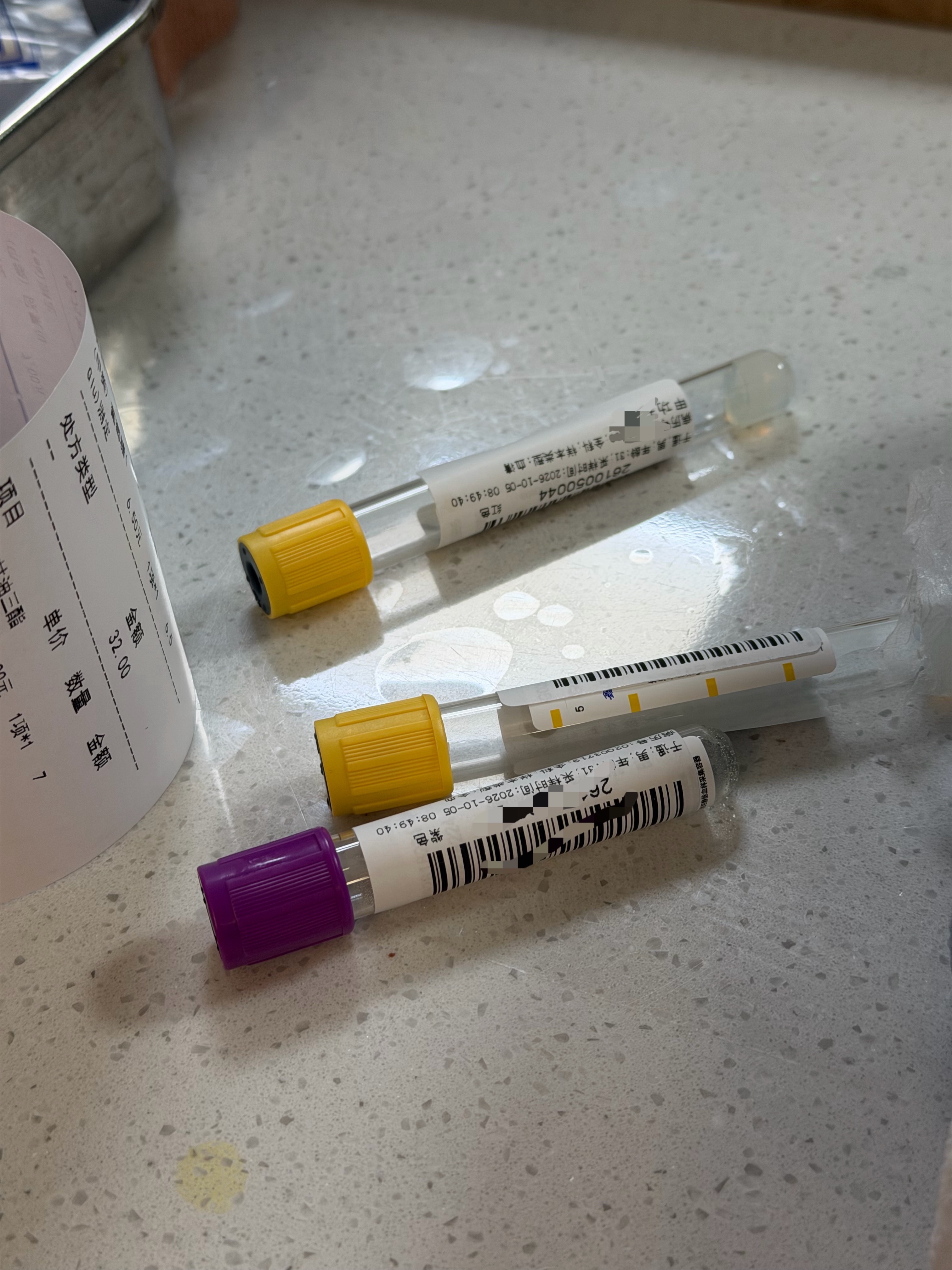 话说大家都多久检查一次？还是不舒服才会去检查？肝功这6个指标正常说明肝健康 ​​