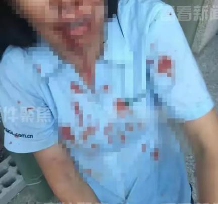 上海，一外甥带5人上门，对舅舅进行围殴，舅妈激愤之下，拿起一瓶强腐蚀性液体，直接