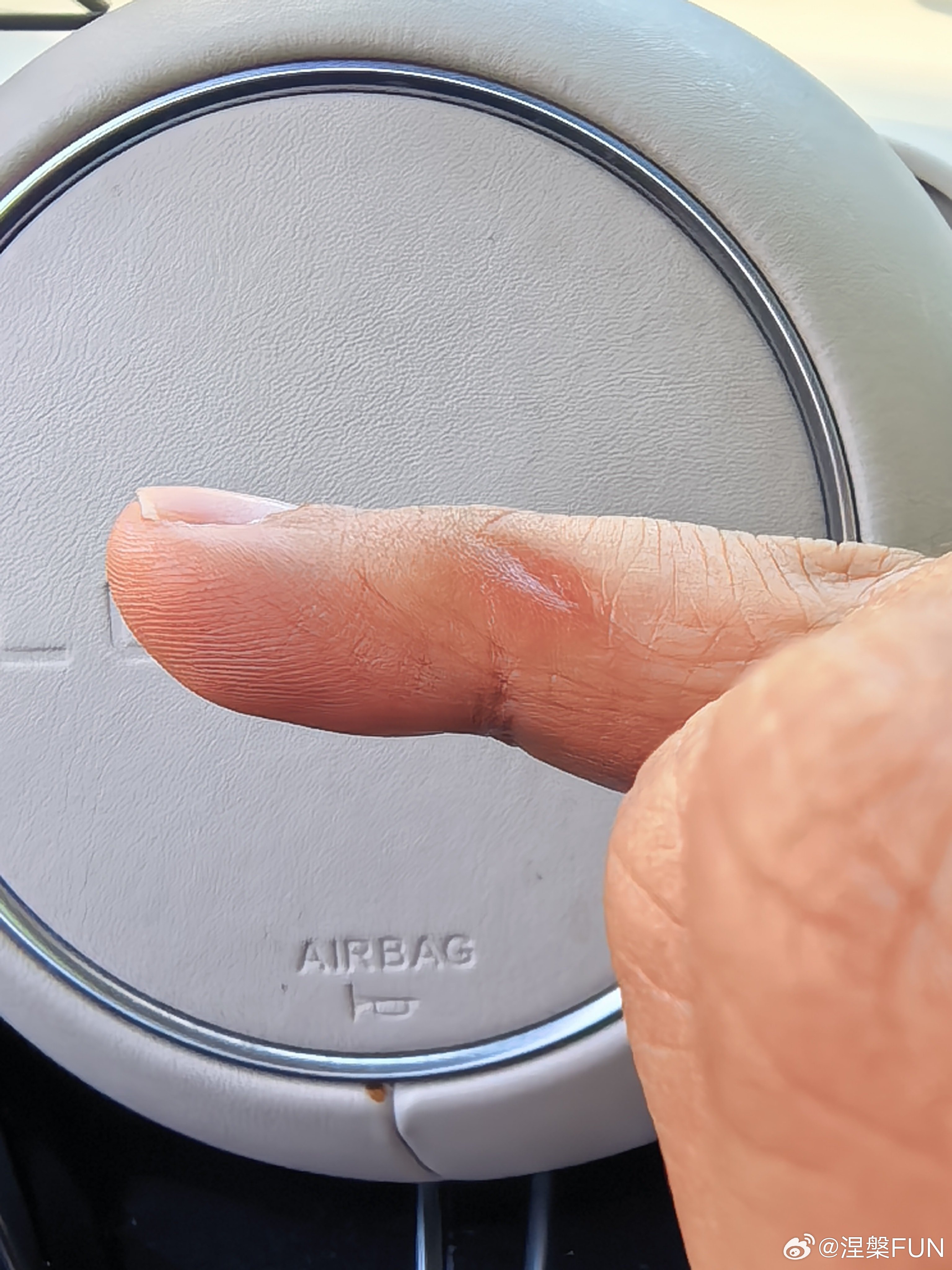 长期用小拇指托手机的后果我这两年都是用折叠屏手机，小拇指已经是这样了！谁来救救我