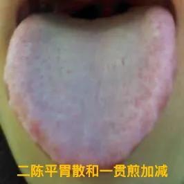 房市不尽人意，经常失望，口干、口苦、口臭、阴囊潮湿。一些人误以为这是因为体内湿热