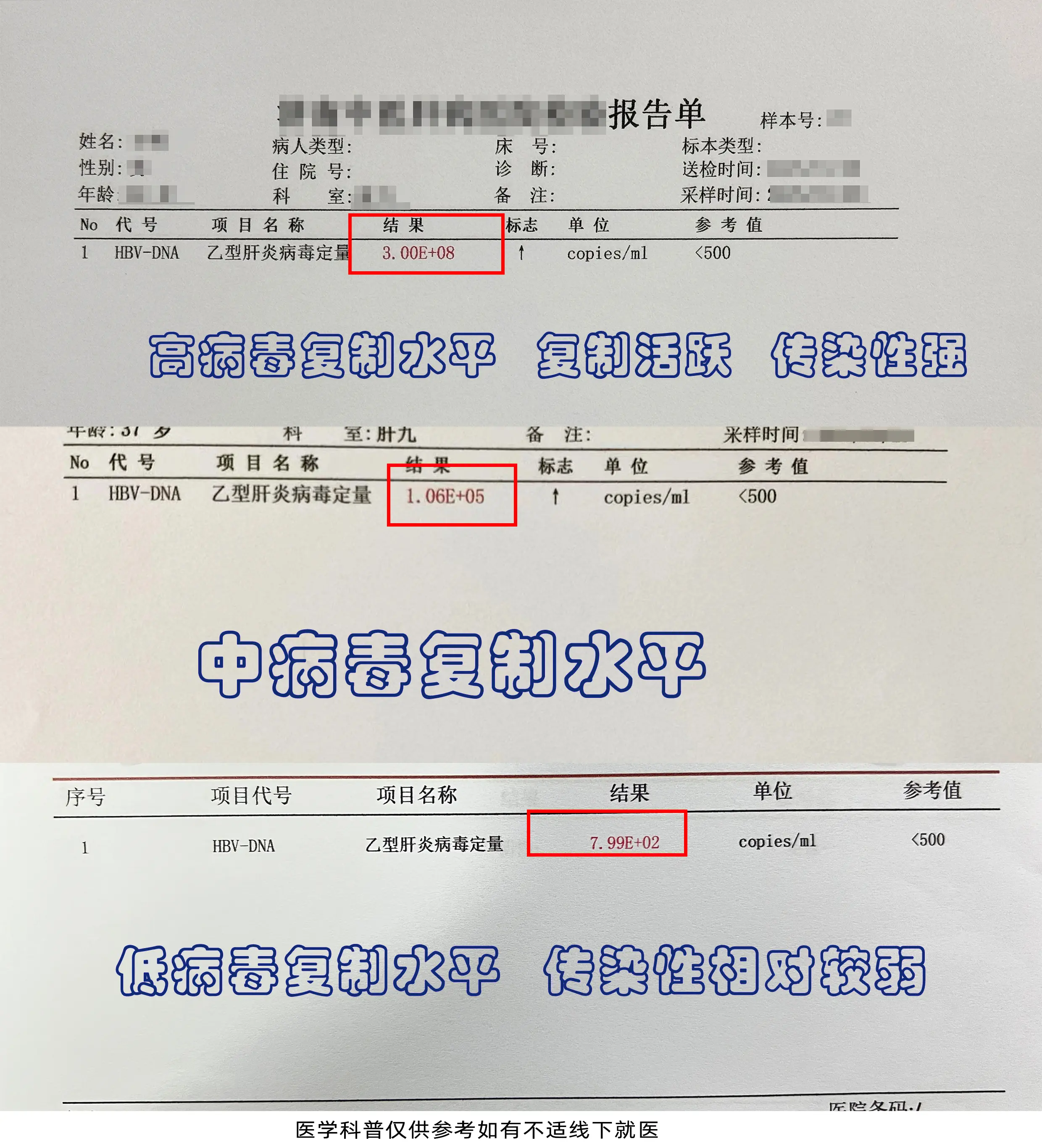 这是最近山东菏泽的一位患者， 大三阳，病毒量8次方，属于高病毒复制水平...