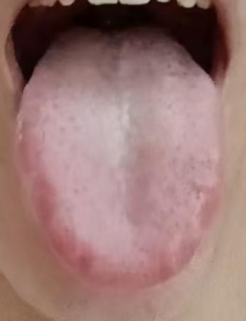 男士精气亏虚身心乏力，中医辨证固本调理科普






最近有一个粉丝朋友给我留
