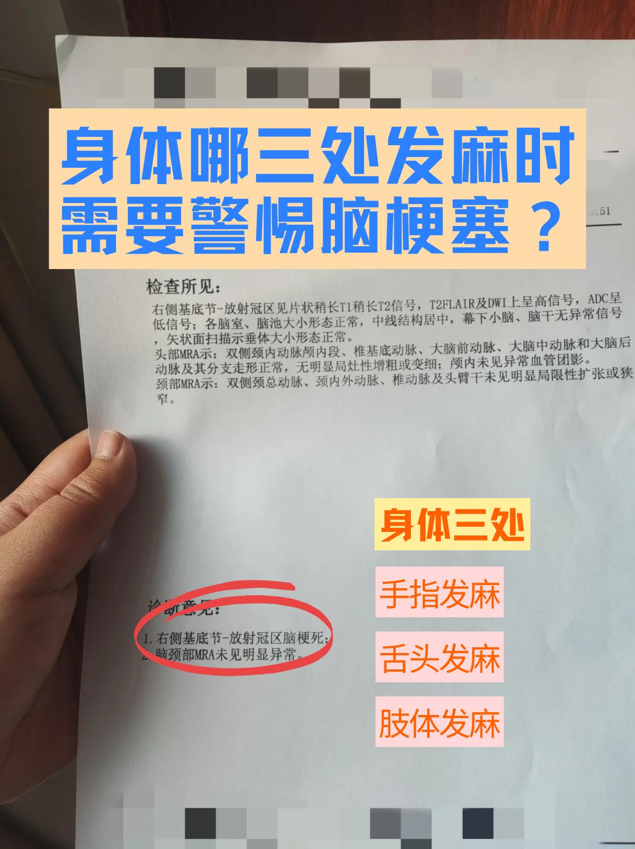 身体这三个地方突然发麻，可能是脑梗在“报警”！

最近，张阿姨在厨房做饭时，突然