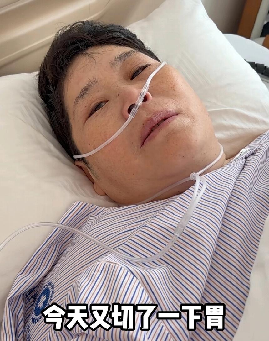 临沂房主任去看膝盖积液却做了切胃手术，事情是这样子的，房主任一直有膝盖疼痛的困扰