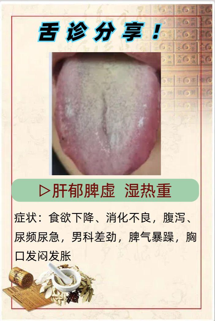 今日舌象分析！

有需要的在下面留下舌头照片，我来帮你辨证分析！！
#中医##舌