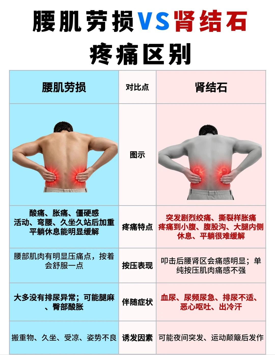 腰疼分不清？教你辨别腰肌劳损与肾结石疼痛