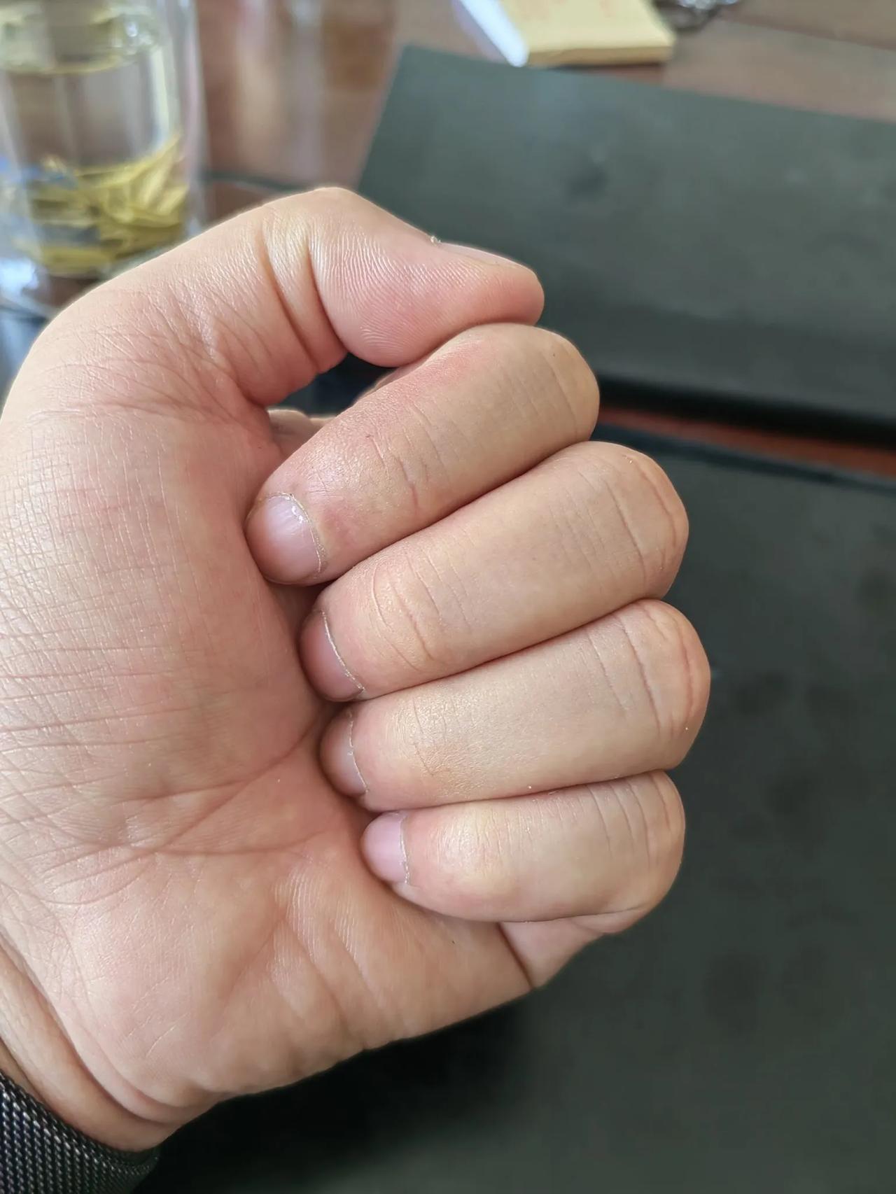 今天被同事说的让我哭笑不得，本来五一加班在补内业资料，但是他突然说起我这双手让我
