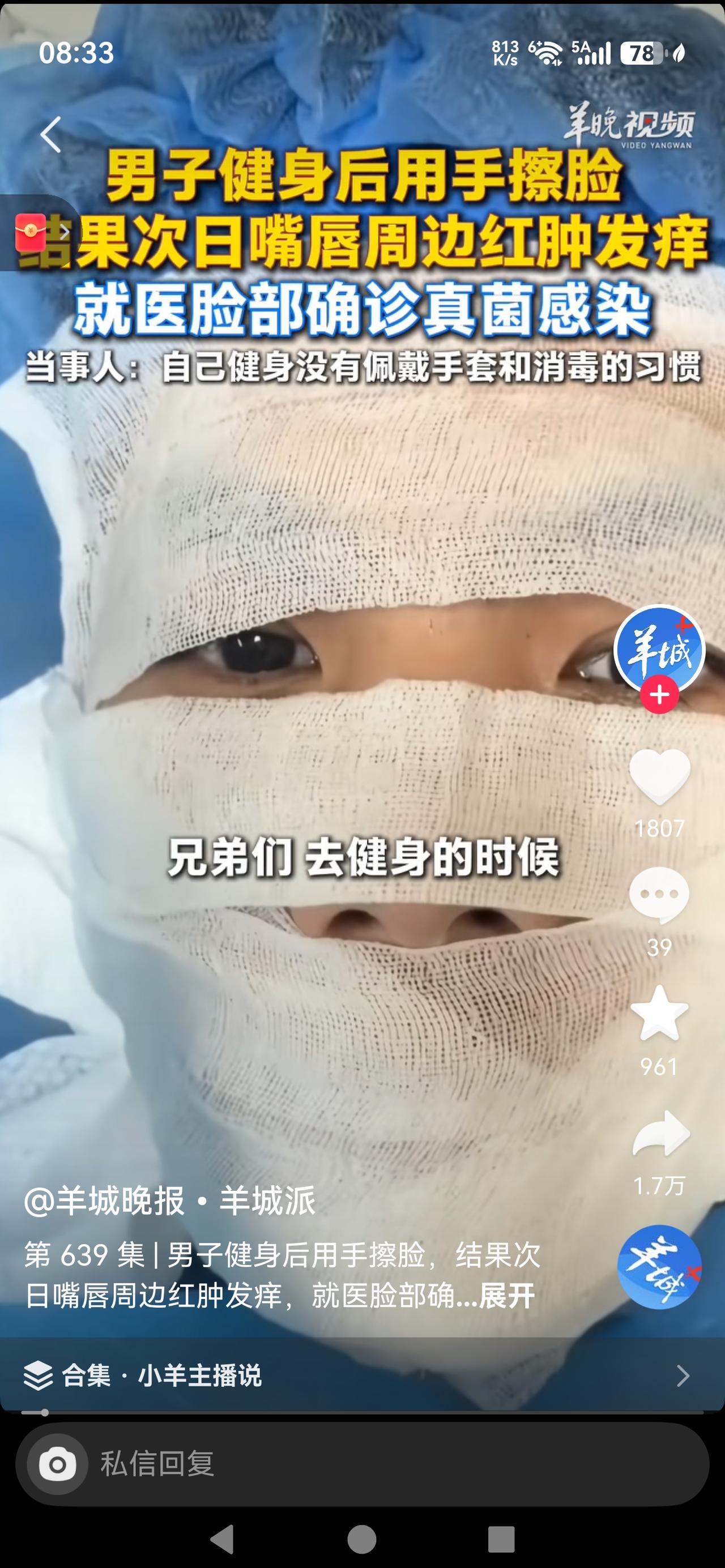 嘴唇周边红肿发痒，就医确诊感染！男子健身回来直接中招儿，健身房的这些隐形坑，比撸
