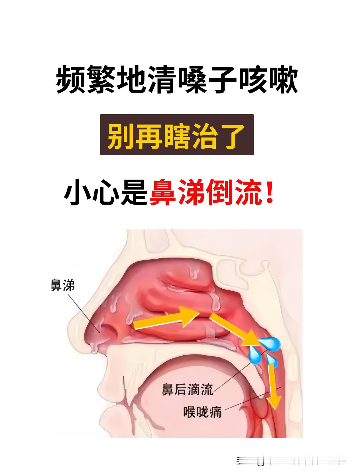 最近看诊了好多鼻涕倒流的患者，居然都给误诊了！

今天看诊了一个7岁的男孩，他的