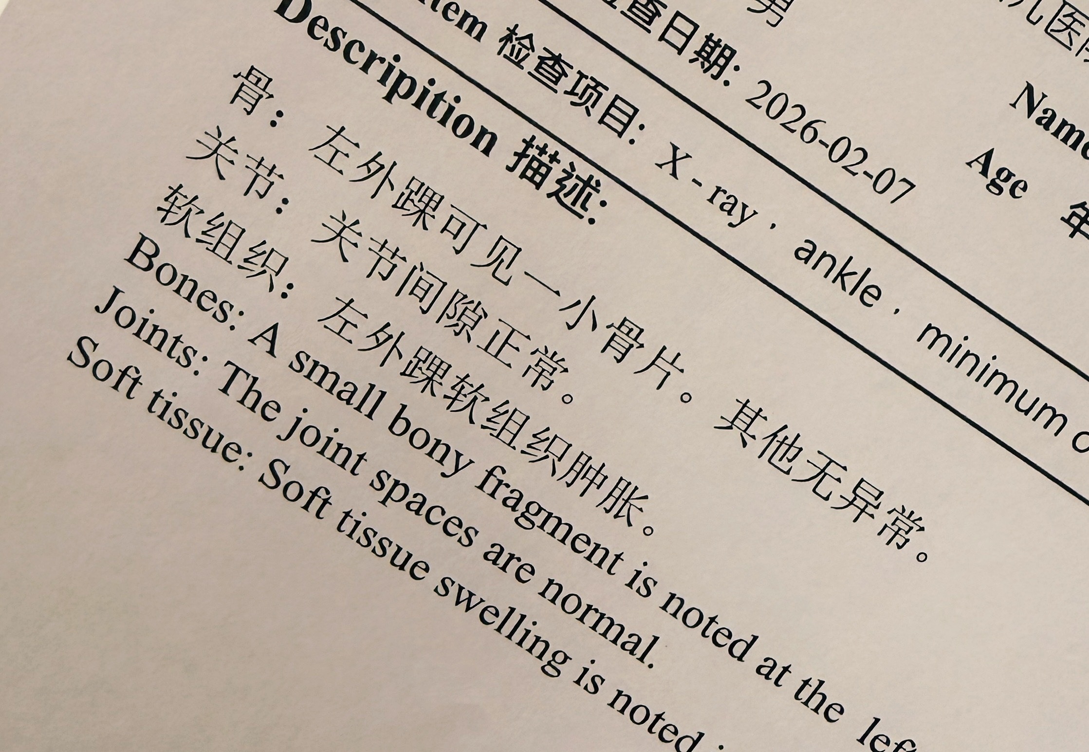 业余生涯最严重的一次“小伤”……撕脱性骨折…..意思是韧带没断，但把一小块骨头扯