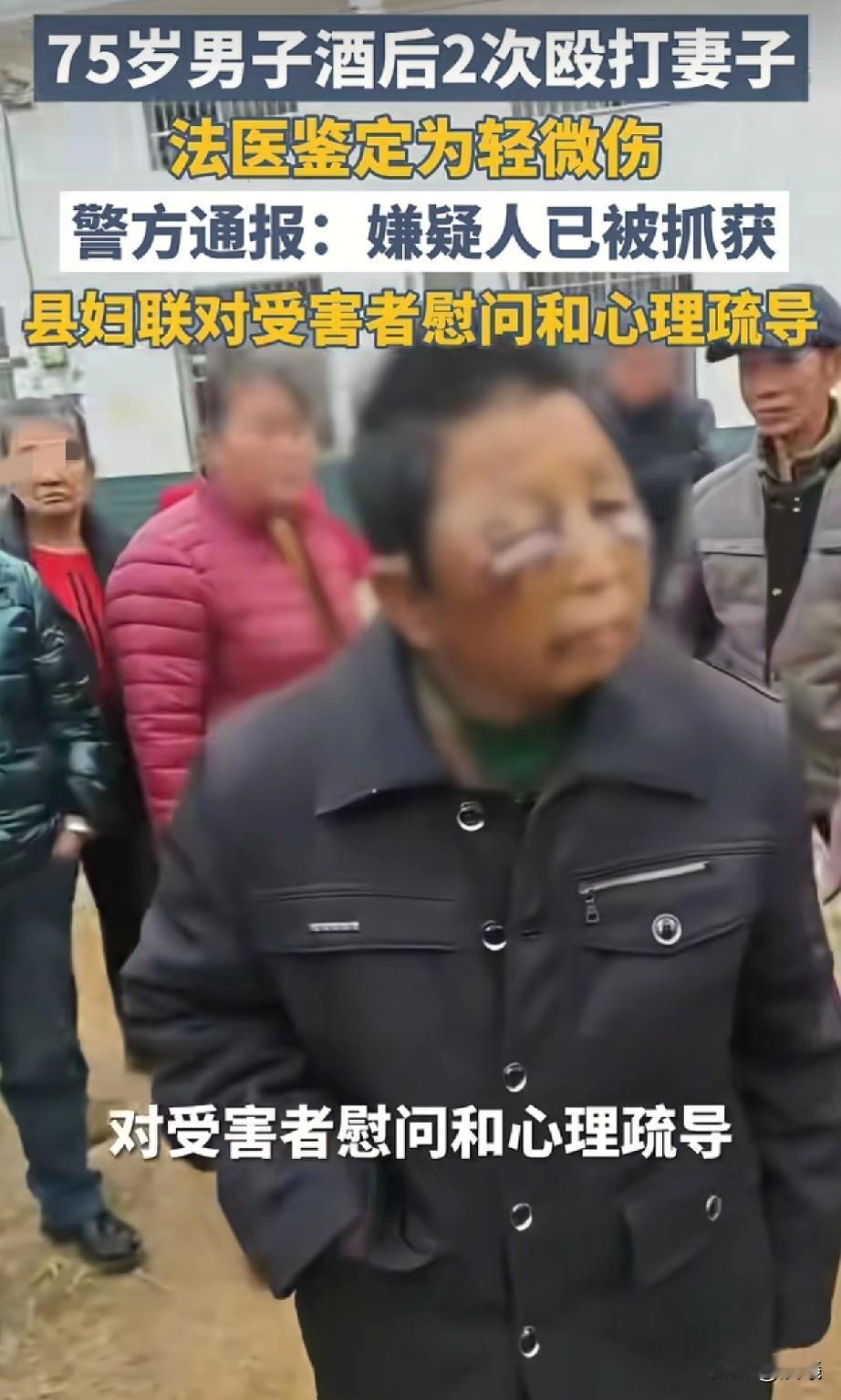 湖南平江女子的伤来自家暴，警方通报75岁丈夫被抓获，知情者称女子才45岁，有儿女