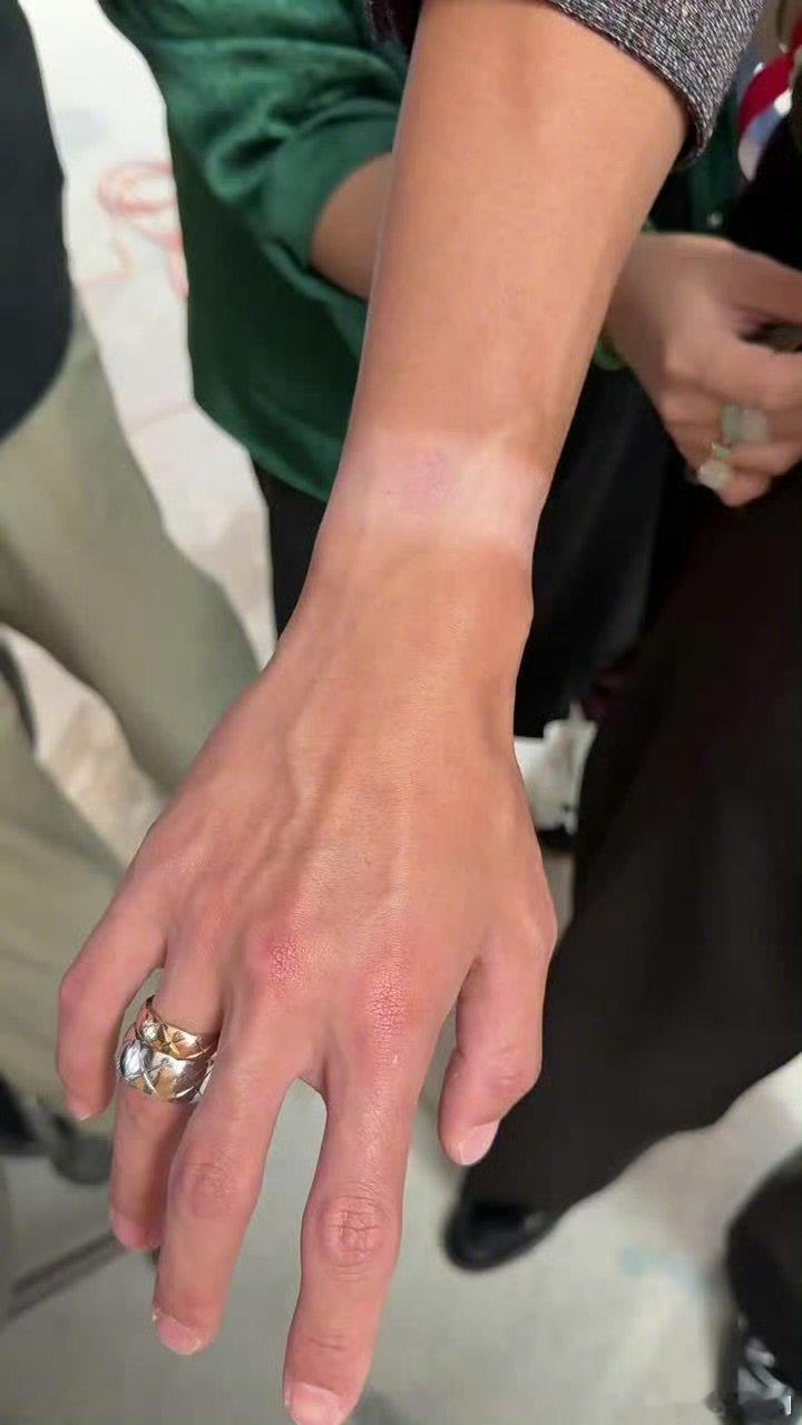 王一博戴同一手表七百多天王一博手腕手表印 好明显的手表印🥹 