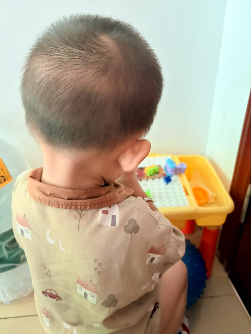 我也是醉了，去年的今天在发烧🤒，今年也是。这是有什么玄学吗？