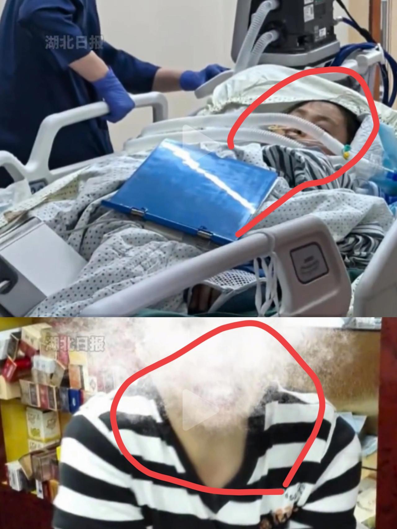 太可怕了！
只是出门散个步而已
竟然把命搭上 
杭州一52岁女子散步时踏到氢氟酸