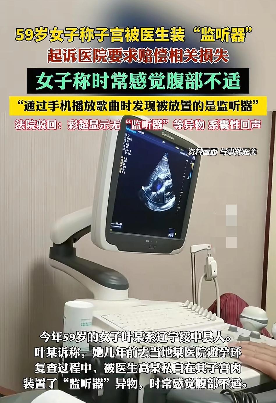 辽宁有位59岁的叶某起诉了医院，说在几年前取环的时候，医生偷偷在她子宫装了“监听