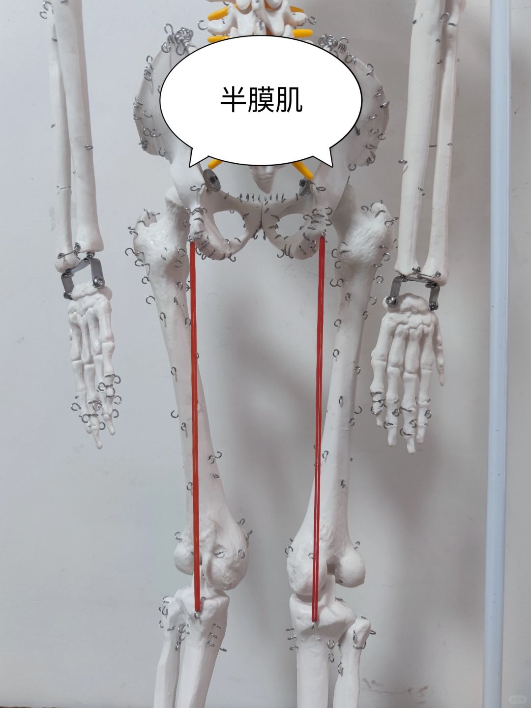 半膜肌